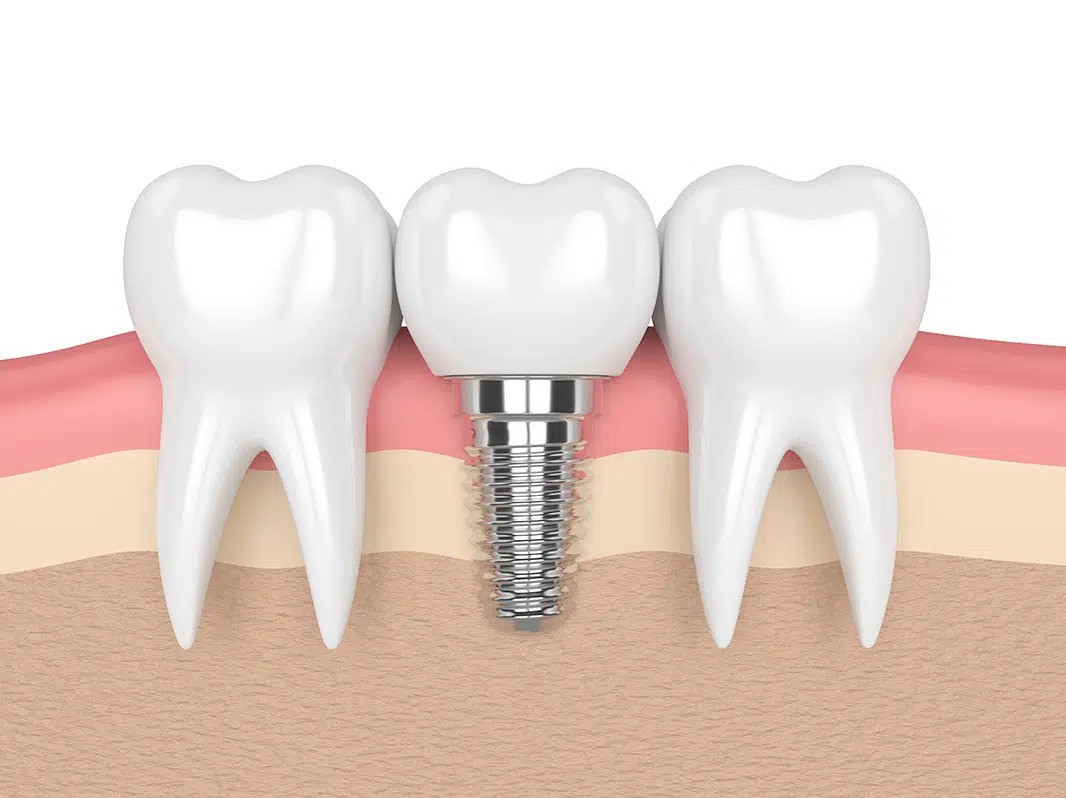 Church Lane Dental